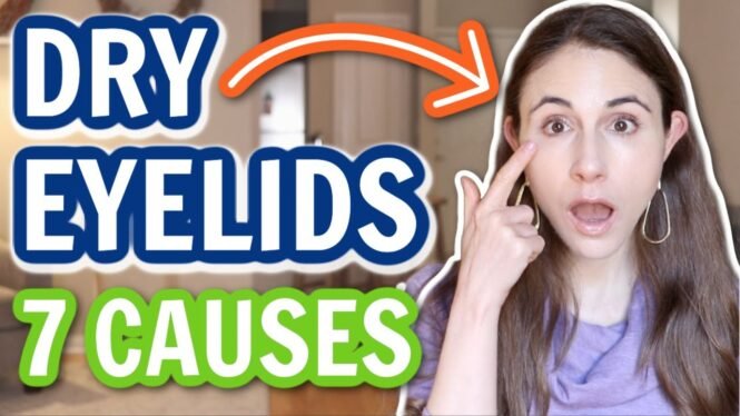 7 REASONS FOR DRY EYELIDS | Dermatologist @DrDrayzday