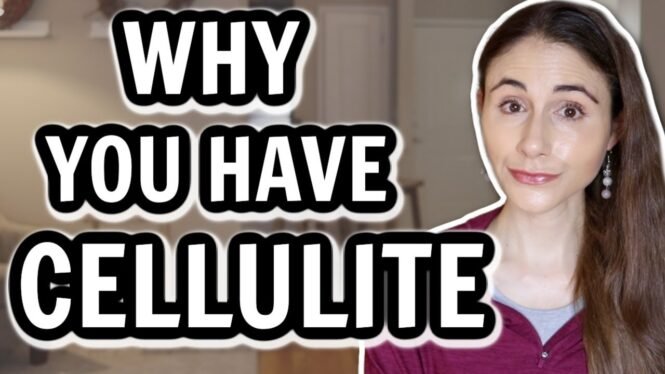 WHY YOU HAVE CELLULITE & HOW TO GET RID OF IT // Dermatologist @DrDrayzday